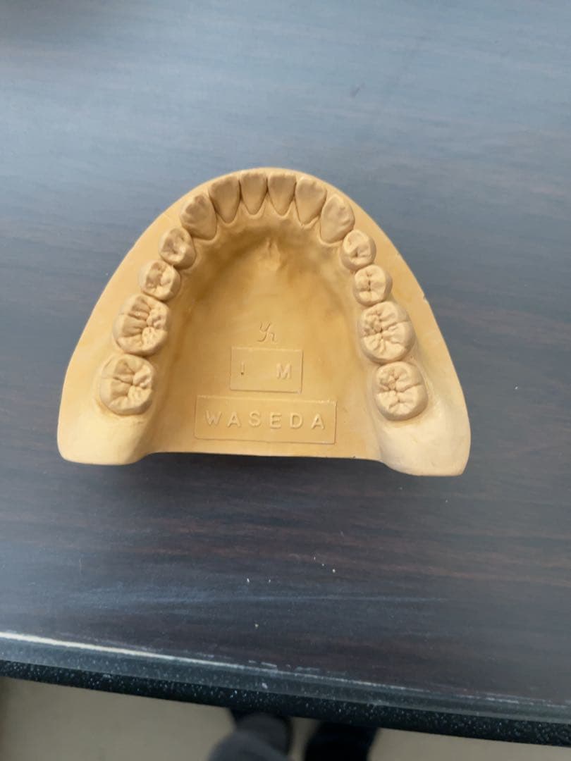 歯科技工　ワセトレ難波氏のサンプル模型です！