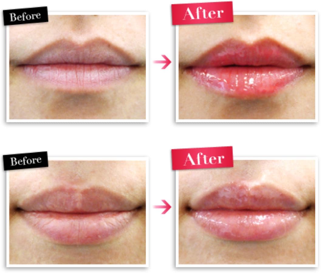 【Luscious Lips】ラシャスリップ リップ美容液 3本セット