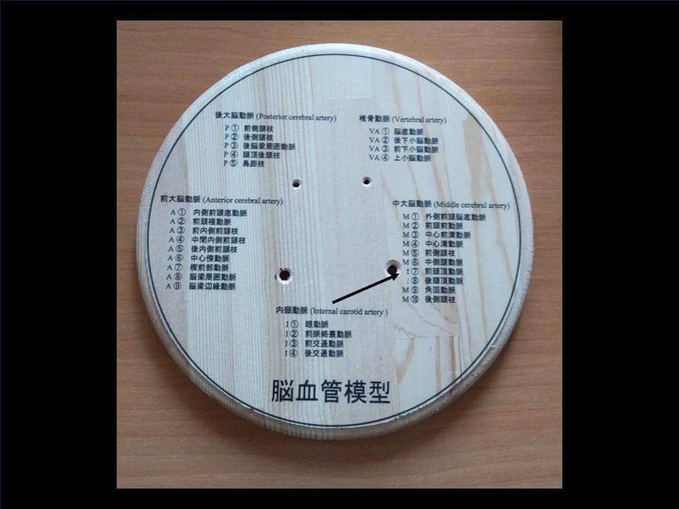 脳血管（内頸動脈、椎骨動脈）模型