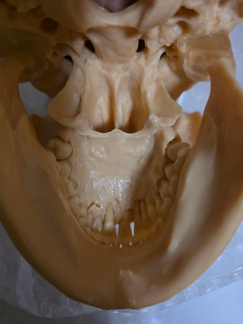 NISSIN DENTAL 頭 歯 模型 アンティーク ガイコツ