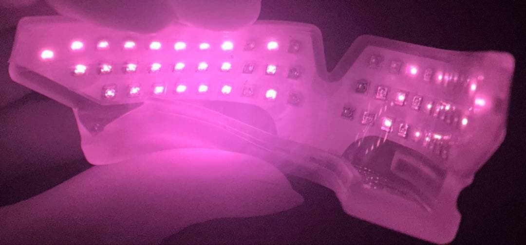 pbm healing オルソパルス 歯列矯正