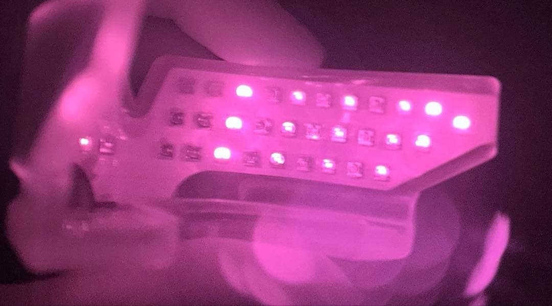 pbm healing オルソパルス 歯列矯正