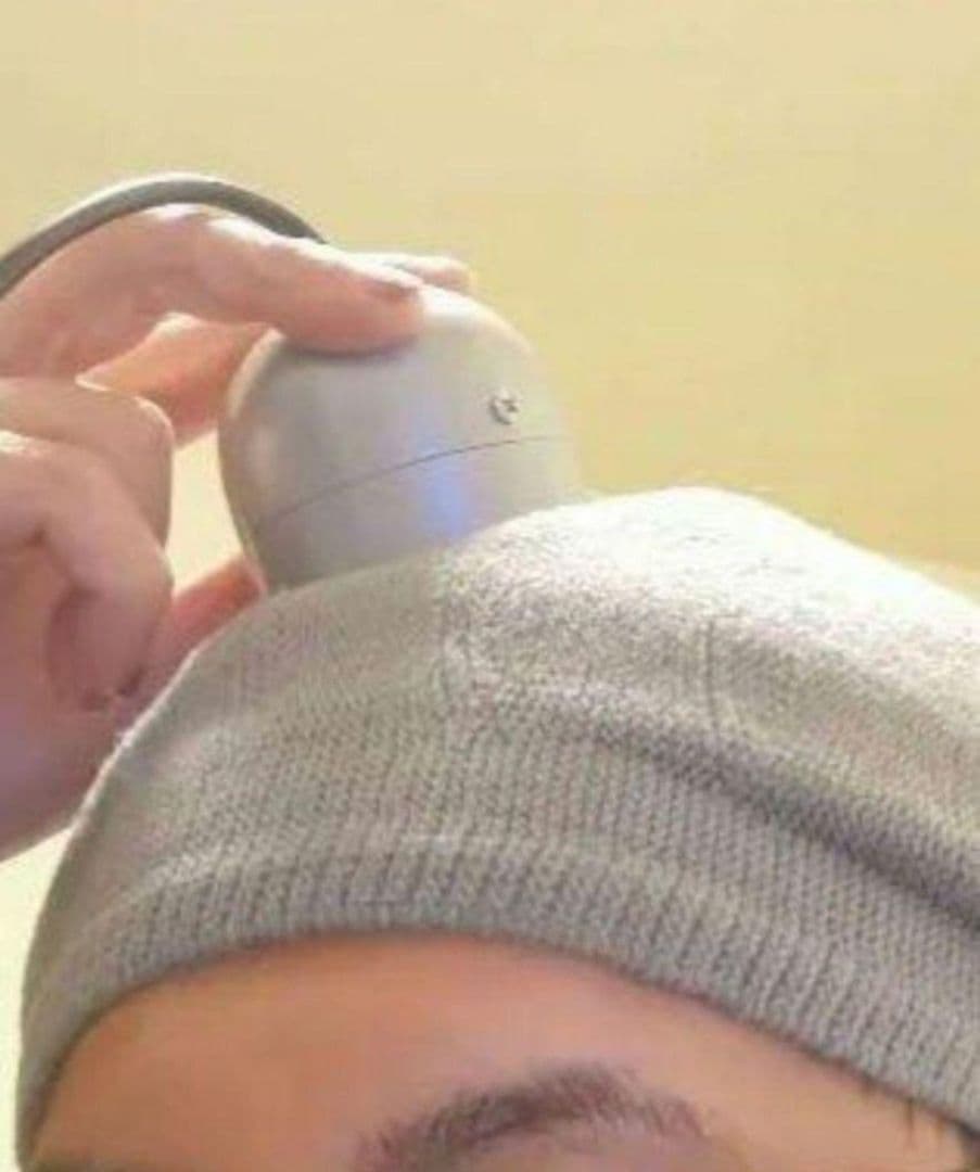 近赤外線　電子灸　星状神経にも