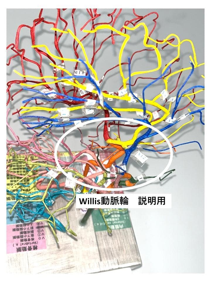 脳血管模型　教育説明用（脳血管模型が必要な人のために）