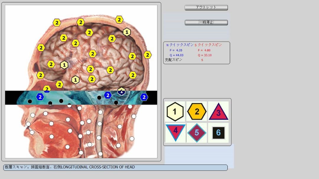 波動測定器 18D CELL NLS 2025 PC& Office2019付