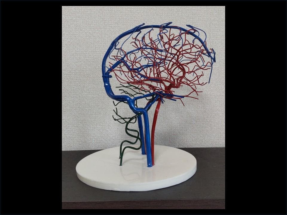 脳血管模型(内頚動脈・椎骨動脈・脳静脈)