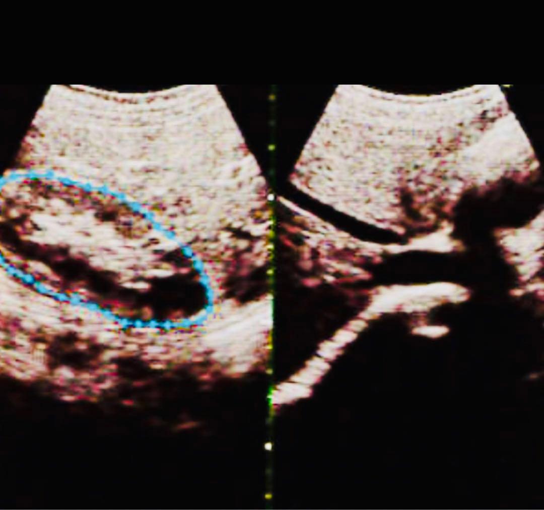 超音波検査装置（エコー）