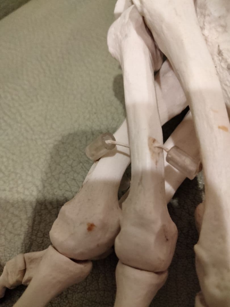 ３Ｂサイエンティフィック　足の骨モデル　脛骨・腓骨付、エラスティックコードつなぎ